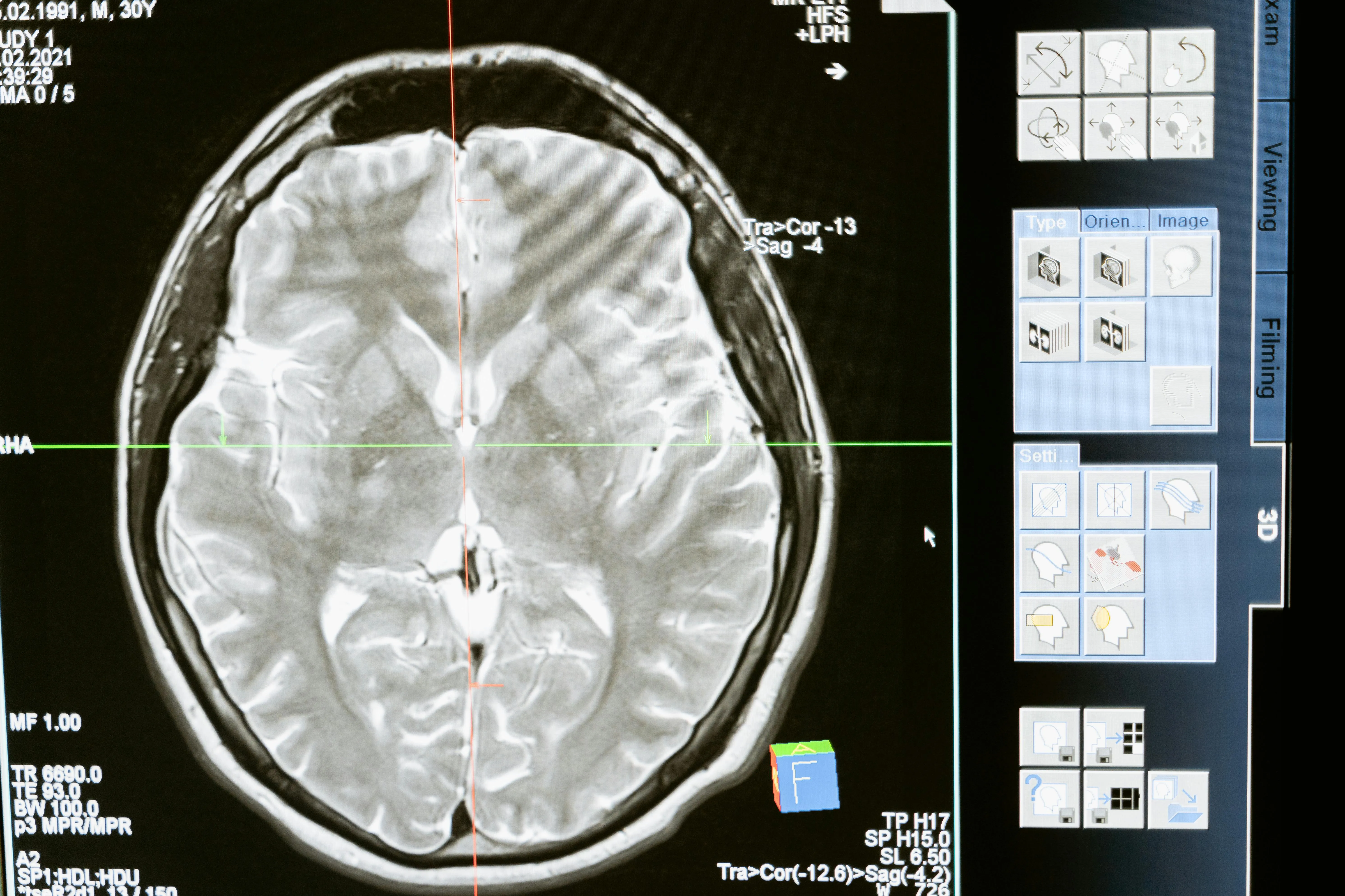 Neurology Consultation