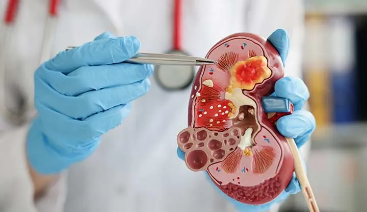 NEPHORLOGY Consultation