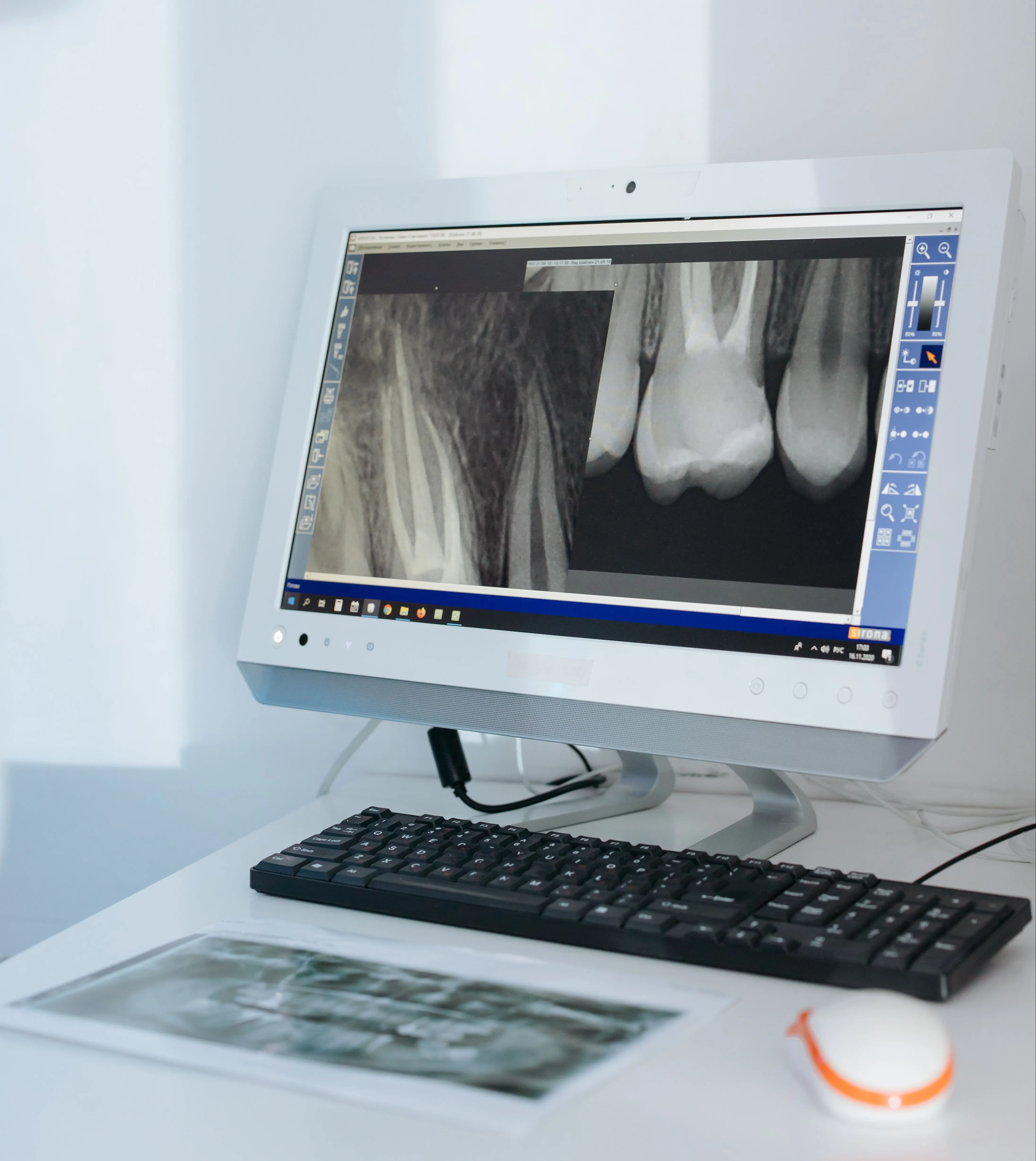 Digital X-Ray